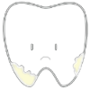 perioicon